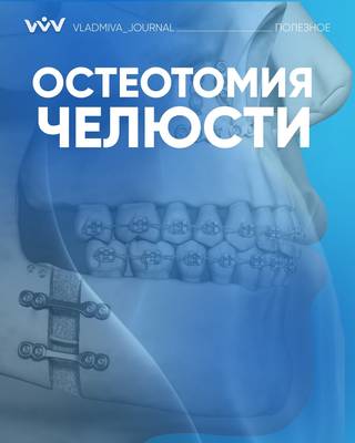 Остеотомия челюсти: 3D-план и точная коррекция прикуса.